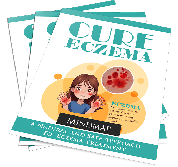 Cure Eczema