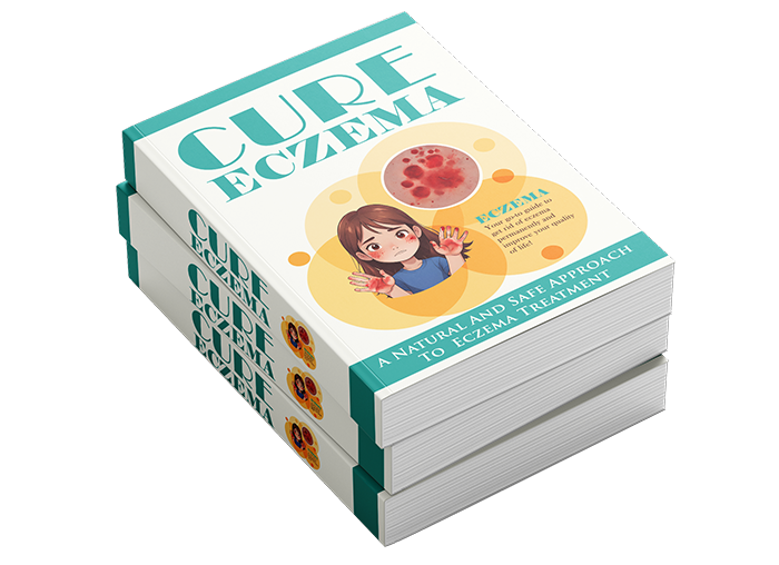 Cure Eczema